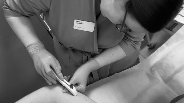 «Импланон: самый надежный метод контрацепции, о котором вы почти ничего не знаете»