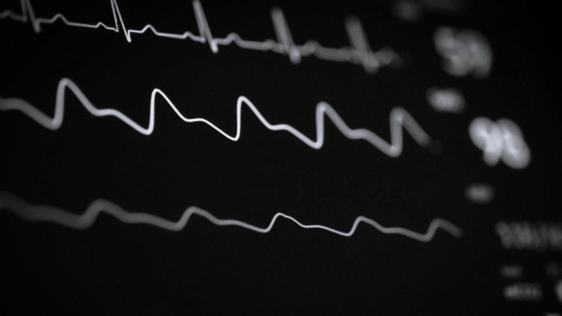 Миф о «рабочем давлении»