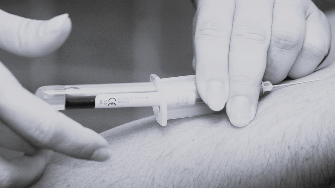 Почему повышается холестерин и всегда ли его нужно лечить