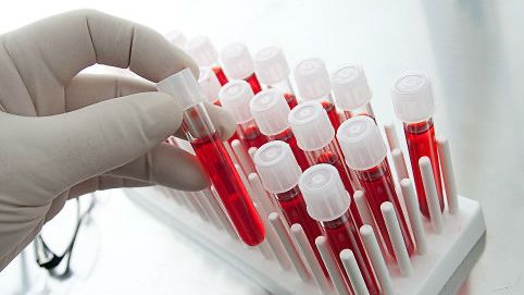 Необходимость рутинного проведения общего анализа крови.