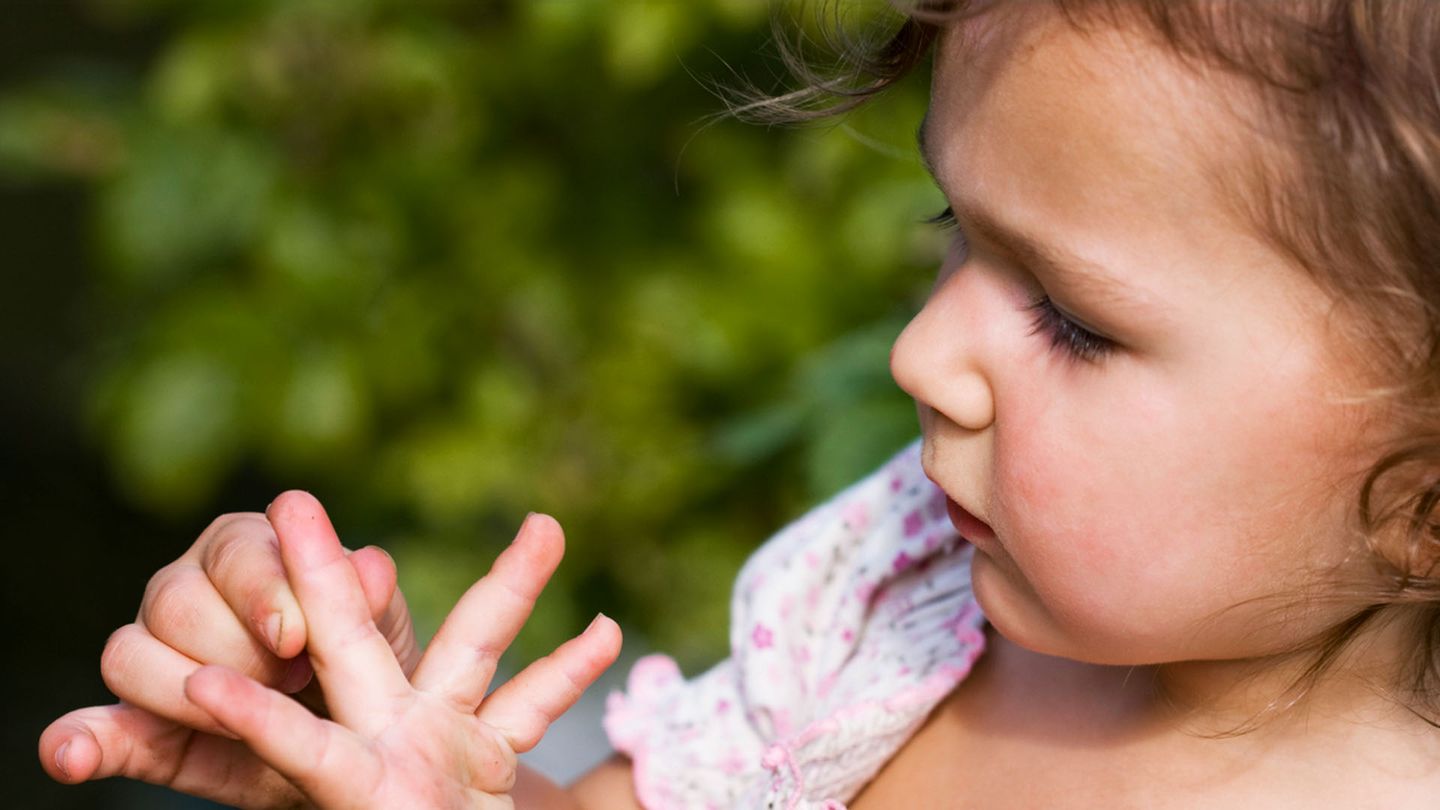 Что делать если у ребенка заноза?